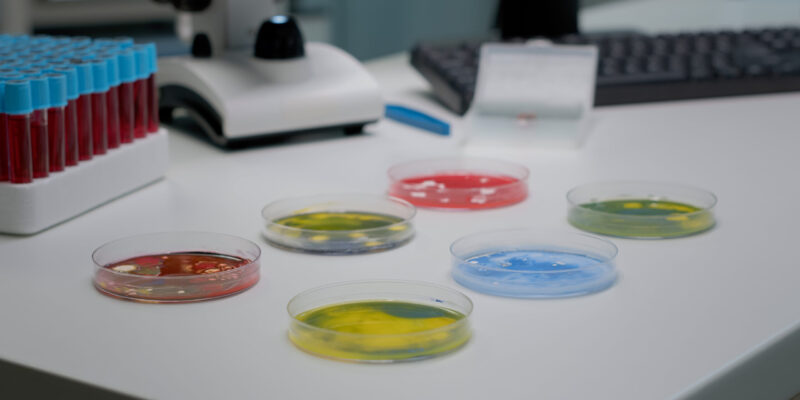 Scientific petri dish holding substance filled with bacteria in laboratory. Organic microbiology experiment with liquid on glass plates for treatment discovery and research development